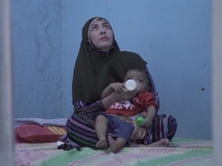 Ibu Penderita Atresia Bilier, Antara Cemas dan Senang Bisa Transplantasi Hati