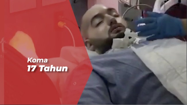 Selain Pangeran Arab, Beberapa Orang Ini Alami Sindrom Putri Tidur