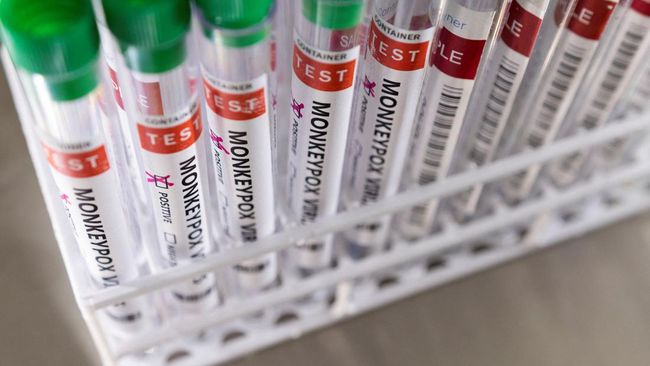 Virus cacar monyet bisa bertahan di benda. Tapi berapa lama virus cacar monyet bisa bertahan di permukaan benda?
