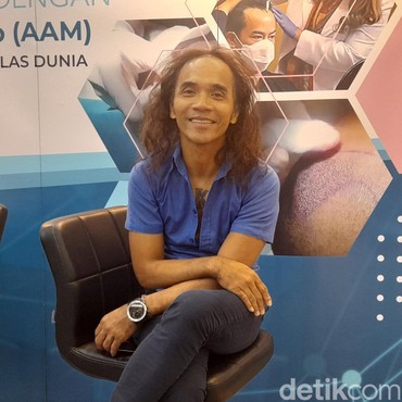 Sadar Alami Kebotakan, Kaka Slank Lakukan Transplantasi Rambut