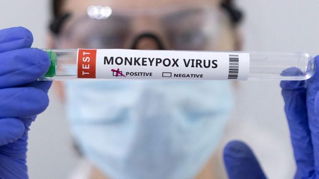 Pusat Pengendalian dan Pencegahan Penyakit AS mengatakan lebih dari 700 kasus cacar monyet atau monkeypox telah terdeteksi di seluruh dunia.