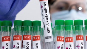 Austria, Ceko, dan Slovenia Laporkan Kasus Pertama Cacar Monyet