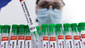 Studi: DNA Virus Cacar Monyet Terdeteksi di Air Liur