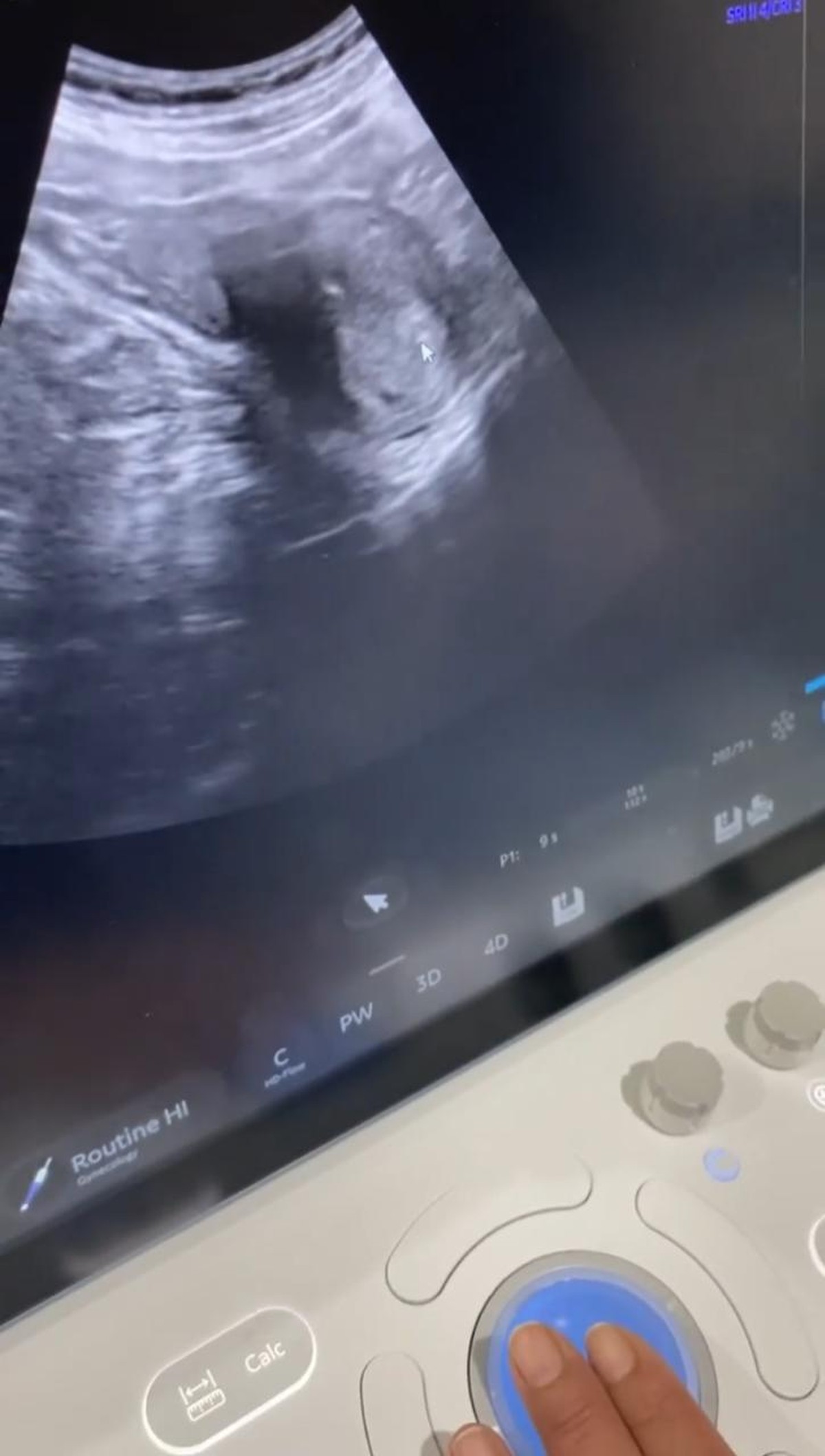 Alvin Faiz dan Henny Rahman