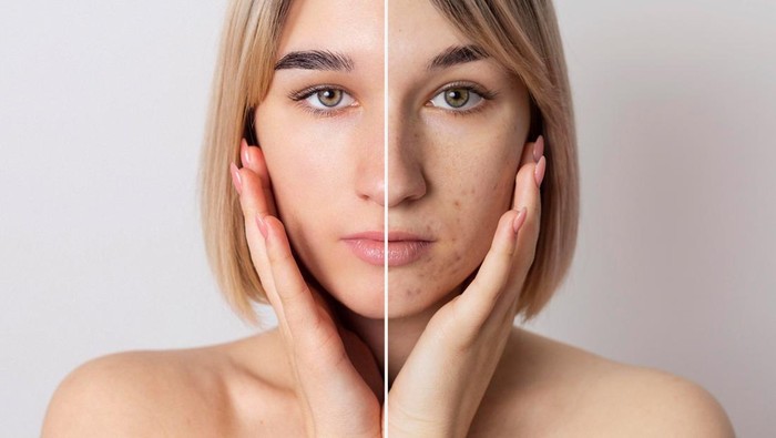 Hati-hati, 4 Makanan Ini Bikin Kamu Gagal Dapat Kulit Glowing dan Sehat! Cek, Ada Favoritmu? Hati-hati, 4 Makanan Ini Bikin Kamu Gagal Dapat Kulit Glowing dan Sehat! Cek, Ada Favoritmu?