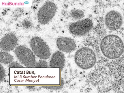 Catat Bun, Ini 3 Sumber Penularan Cacar Monyet
