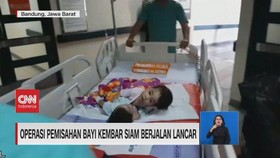VIDEO: Operasi Pemisahan Bayi Kembar Siam Berjalan Lancar