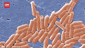 VIDEO: Hal-hal yang Perlu Diketahui soal Salmonella