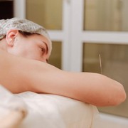 Benarkah Akupunktur Bisa Mengatasi Insomnia? Ini Penjelasan Ahli!