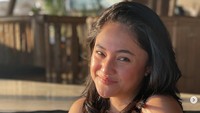 Perjuangan Marshanda Sembuh dari Tumor Payudara, Jalani Ayurveda di Bali