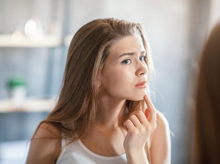 5 Penyebab Timbulnya Jerawat Dagu, Bukan Cuma Perkara Skincare Bun