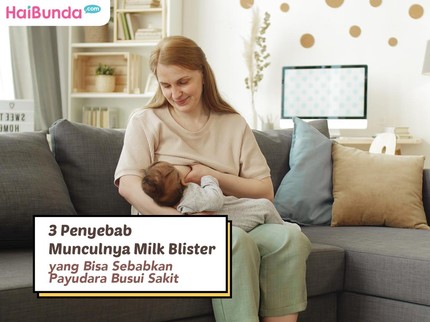 3 Penyebab Munculnya Milk Blister yang Bisa Sebabkan Payudara Busui Sakit