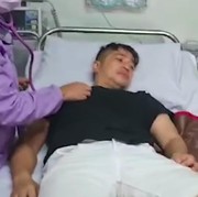 Irfan Hakim Tumbang karena Keripik Pedas, Ini Dampak Jangka Panjang dari Kebiasaan Makan Pedas! Duh...