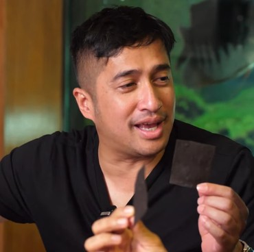 Irfan Hakim Kesal Cerita Sakit Usai Makan Keripik Pedas Disebut Cari Sensasi