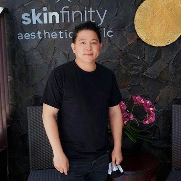 8 Potret Terbaru Steven Rumangkang yang Hampir Menikah dengan Angelina Sondakh