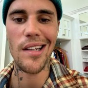 Ramsay Hunt Syndrome yang Diidap Justin Bieber, Apakah Penyakit yang Bisa Dicegah?