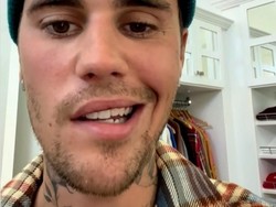 Curhat Justin Bieber Frustasi Wajahnya Lumpuh Sebelah Imbas Sindrom Ramsay Hunt