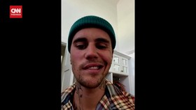 VIDEO: Lumpuh Wajah Sebagian, Justin Bieber Batal Konser di Toronto