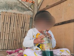 Kebiasaan Nyeleneh Balita Asal Sampang yang Hobi Hirup Bau Bensin