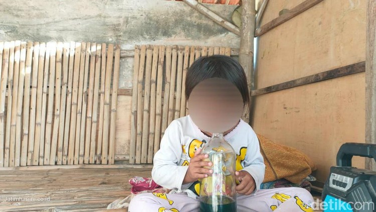 Balita di Sampang kecanduan hirup bensin Balita di Sampang kecanduan hirup bensin