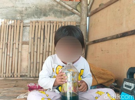 Duh! Balita di Sampang Kecanduan Hirup Aroma Bensin, Begini Kondisinya
