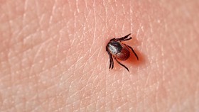 Mengenal Infeksi Virus Powassan, Menular Lewat Gigitan Kutu