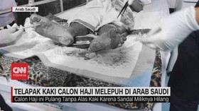 VIDEO: Telapak Kaki Calon Haji Melepuh di Arab Saudi