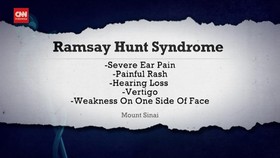 VIDEO: Ramsay Hunt Syndrome yang Bikin Justin Bieber Lumpuh Wajah