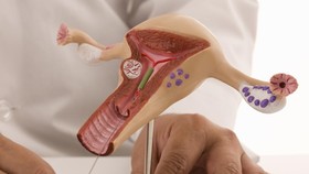 5 Cara Membersihkan Vagina yang Benar, Jangan Pakai Sabun