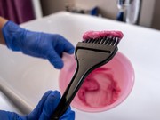 Mengenal Gejala dan Cara Tes Alergi Cat Rambut