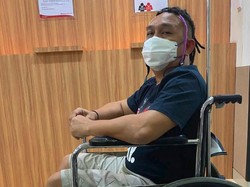 Augie Fantinus Dilarikan ke RS, Jalani Operasi Usus Buntu sampai Masuk ICU