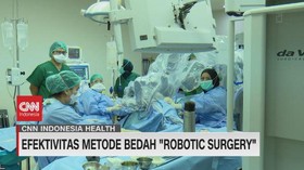 VIDEO: Efektifitas Metode Bedah 