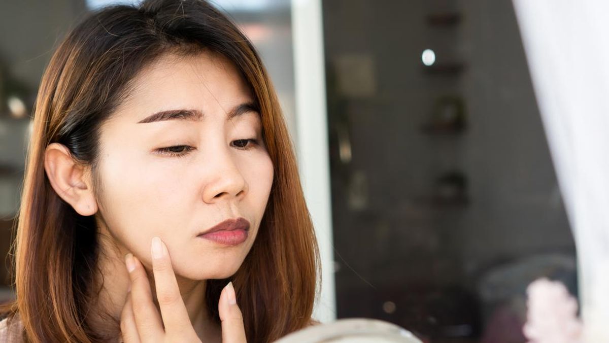 Bibir Hitam Tak Selalu karena Lipstik, Ini Penyebab Aslinya