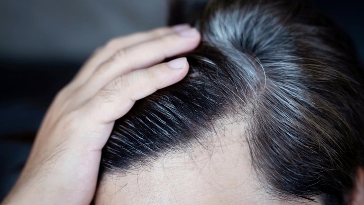 A man has hair growth, he has hair loss problems. Dry scalp, dandruff