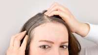Penyebab Rambut Beruban Menurut Penelitian Selain Penuaan, Kurang Vitamin hingga Merokok