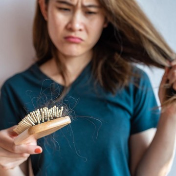 img-title Benarkah Ketombe Bisa Bikin Rambut Lebih Mudah Rontok? Ini Penjelasannya