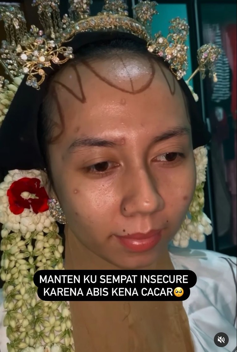Makeup Pengantin Bekas Cacar Viral Makeup Pengantin Bekas Cacar Viral