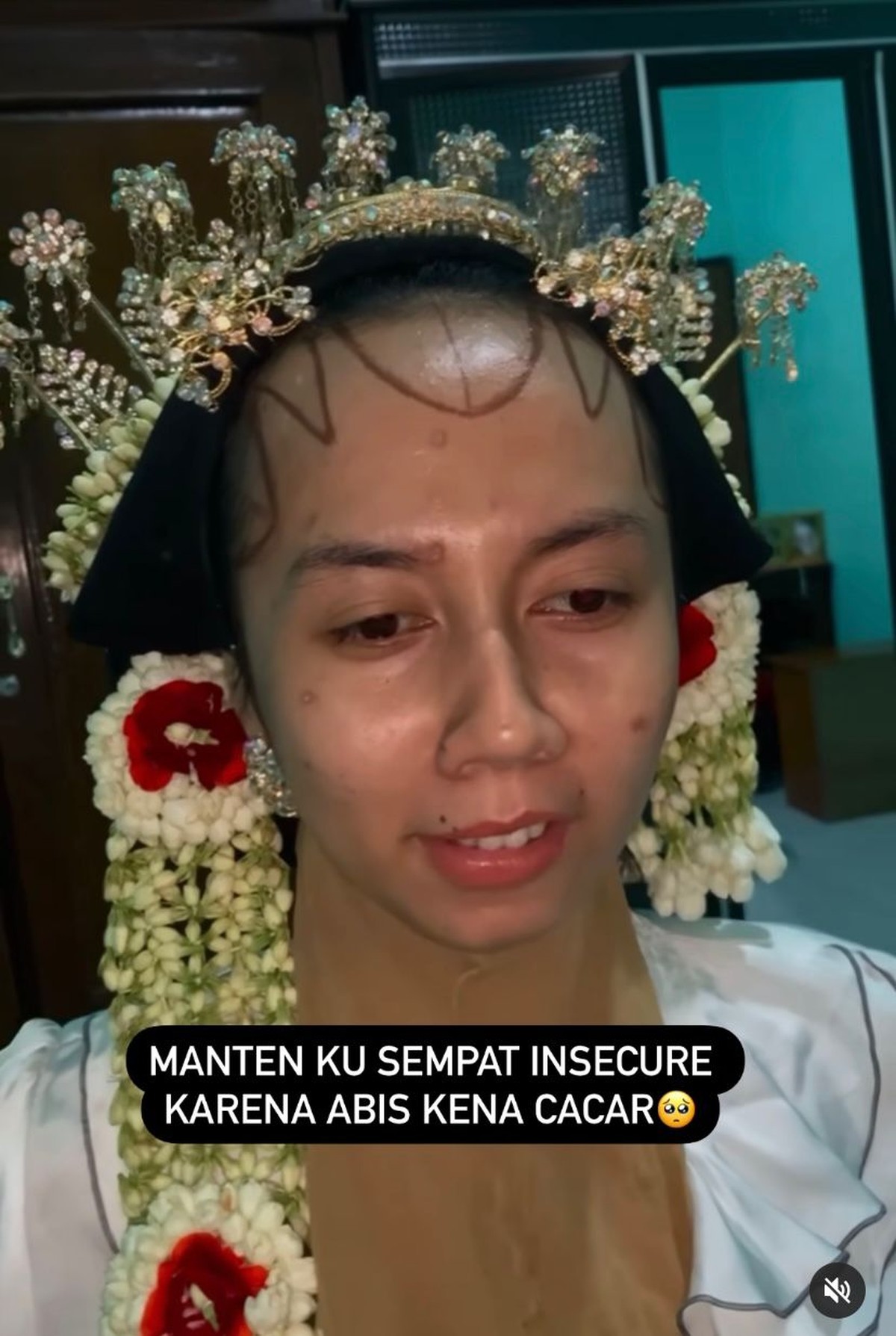 Makeup Pengantin Bekas Cacar Viral