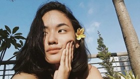 Dialami Arawinda Kirana, Apa Itu Vaginismus?