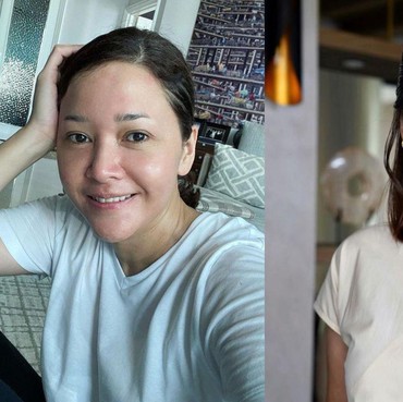 7 Potret Before-After Maia Estianty Lakukan Laser & Botox