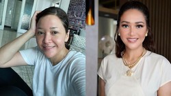 img-title 7 Potret Before-After Maia Estianty Lakukan Laser & Botox