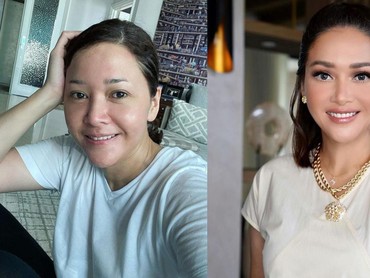 7 Potret Before-After Maia Estianty Lakukan Laser & Botox