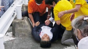 Shinzo Abe Meninggal Dunia, Dokter Sebut Peluru Tembus Jantung