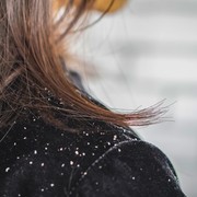 Jangan Anggap Sepele, Ini 3 Penyakit yang Ditandai dengan Serpihan Ketombe Pada Awalnya!