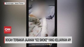 VIDEO: Bocah Terbakar Jajanan 