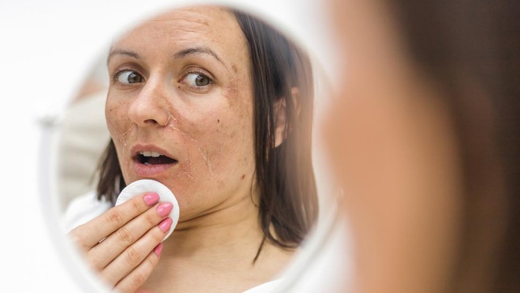 Photo of woman having skin problems looking in the mirror. Concept of skincare.