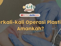 Operasi Bedah Plastik Seperti Ini Bisa Berujung Fatal
