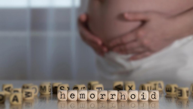 Word HEMORRHOID composed of wooden letters. Pregnant woman in the background