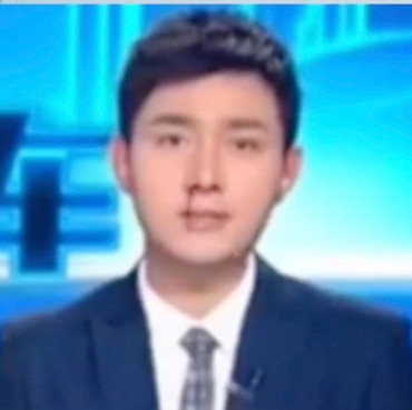 Mimisan Parah, Jurnalis Bertahan Baca Berita karena Takut Dipecat Atasan