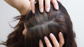 Tanpa Kulit Kepala, Ilmuwan Tumbuhkan Rambut di Laboratorium
